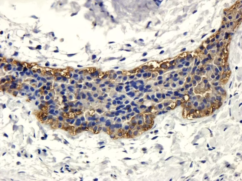 IHC CD133