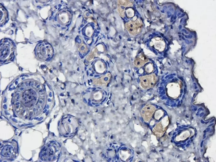 IHC-P CD163