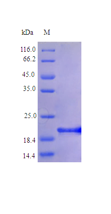 Human IL-6 Protein SDS-PAGE
