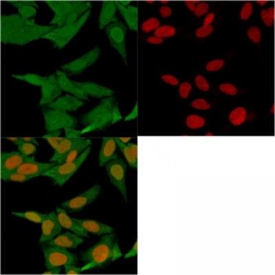 Fibroblast specific protein 1 (FSP1)