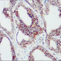 HER2 Staining