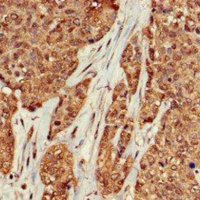 KRAS Staining