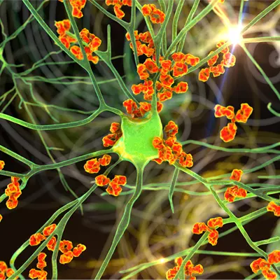 Immunology & Inflammation