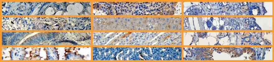 IHC Tips and Tricks