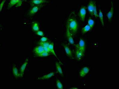YWHAH Antibody