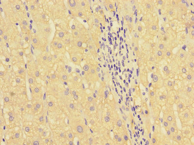 HOXA2 Antibody