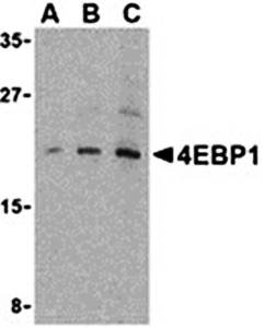 4E-BP1 Antibody