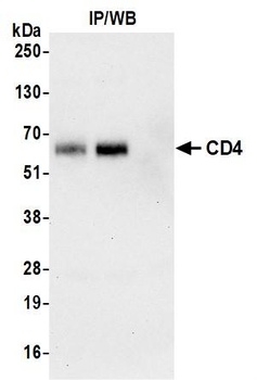 Rabbit anti-CD4 Recombinant Monoclonal Antibody [BLR167J]