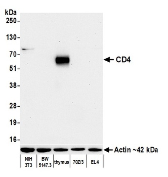 Rabbit anti-CD4 Recombinant Monoclonal Antibody [BLR167J]