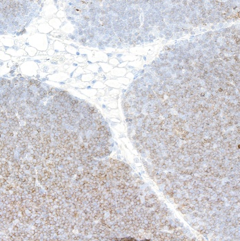 Rabbit anti-CD4 Recombinant Monoclonal Antibody [BLR167J]