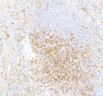 Rabbit anti-CD4 Recombinant Monoclonal Antibody [BLR167J]