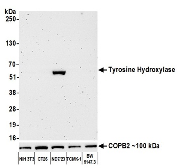 Rabbit anti-Tyrosine Hydroxylase Recombinant Monoclonal Antibody [BLR155J]