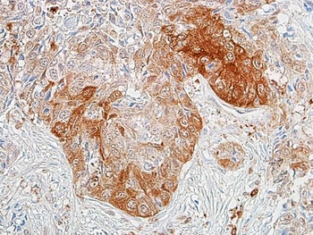 Rabbit anti-ALDH1A1 Recombinant Monoclonal Antibody [BLR089G]