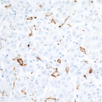 Rabbit anti-CD163 Recombinant Monoclonal Antibody [BLR087G]