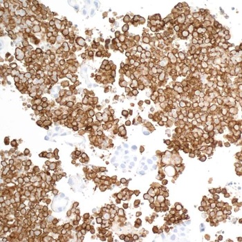 Rabbit anti-CD163 Recombinant Monoclonal Antibody [BLR087G]