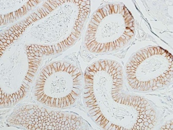 Rabbit anti-beta Catenin Recombinant Monoclonal Antibody [BLR086G]