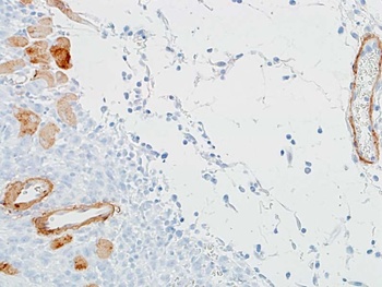 Rabbit anti-alpha Smooth Muscle Actin Recombinant Monoclonal Antibody [BLR082G]