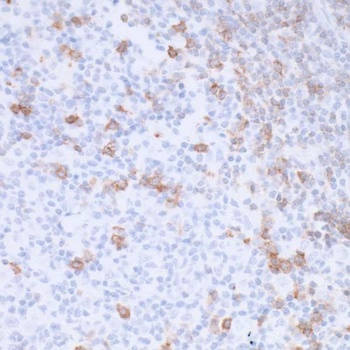 Rabbit anti-PD-1 Recombinant Monoclonal Antibody [BLR076G]