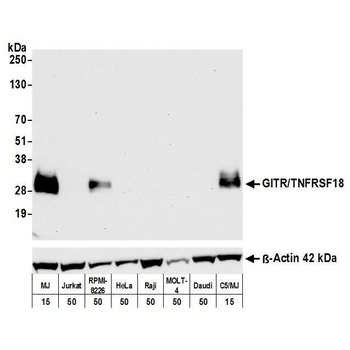 Rabbit anti-GITR/TNFRSF18 Recombinant Monoclonal Antibody [BLR068G]