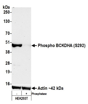 Rabbit anti-Phospho BCKDHA (S292) Recombinant Monoclonal Antibody [BLR060F]