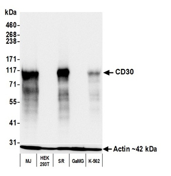 Rabbit anti-CD30 Recombinant Monoclonal Antibody [BLR055F]