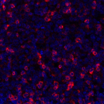 Rabbit anti-TIGIT Recombinant Monoclonal Antibody [BLR047F]