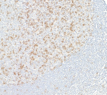 Rabbit anti-TIGIT Recombinant Monoclonal Antibody [BLR047F]