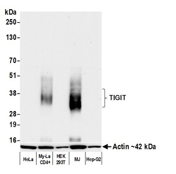 Rabbit anti-TIGIT Recombinant Monoclonal Antibody [BLR047F]