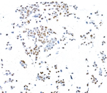 Rabbit anti-CTCF Recombinant Monoclonal Antibody [BLR041F]