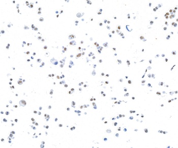 Rabbit anti-CTCF Recombinant Monoclonal Antibody [BLR041F]
