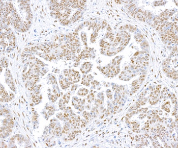 Rabbit anti-CTCF Recombinant Monoclonal Antibody [BLR041F]