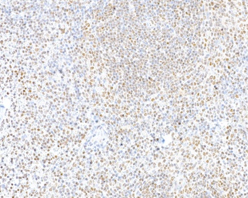 Rabbit anti-CTCF Recombinant Monoclonal Antibody [BLR041F]