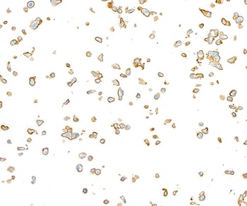Rabbit anti-CD44 Recombinant Monoclonal Antibody [BLR038F]