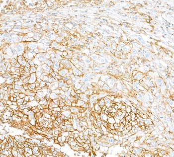 Rabbit anti-CD44 Recombinant Monoclonal Antibody [BLR038F]