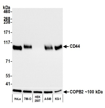 Rabbit anti-CD44 Recombinant Monoclonal Antibody [BLR038F]