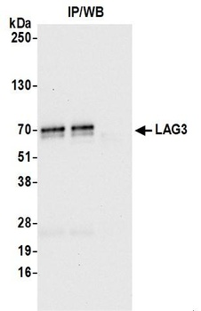 Rabbit anti-LAG3 Recombinant Monoclonal Antibody [BLR027F]