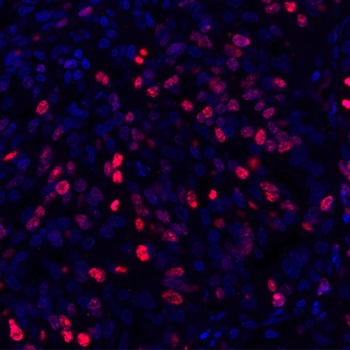 Rabbit anti-Ki-67 Recombinant Monoclonal Antibody [BLR021E]