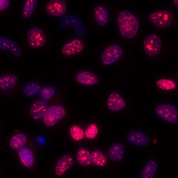 Rabbit anti-Ki-67 Recombinant Monoclonal Antibody [BLR021E]