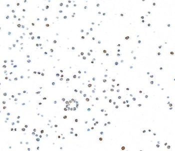 Rabbit anti-Ki-67 Recombinant Monoclonal Antibody [BLR021E]