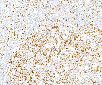 Rabbit anti-Ki-67 Recombinant Monoclonal Antibody [BLR021E]