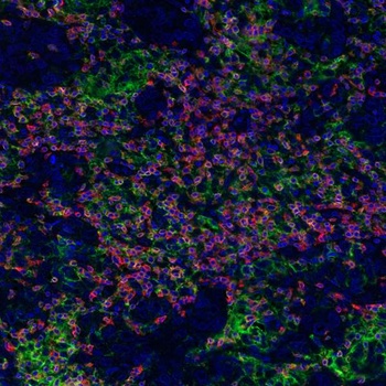 Rabbit anti-PD-L1 Recombinant Monoclonal Antibody [BLR020E]