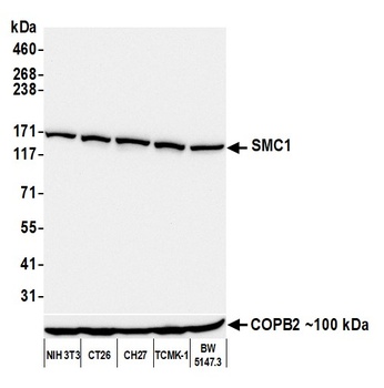 Rabbit anti-SMC1 Recombinant Monoclonal Antibody [BL-205-2G8]