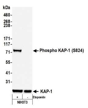 Rabbit anti-Phospho KAP-1 (S824) Recombinant Monoclonal Antibody [BL-246-7B5]