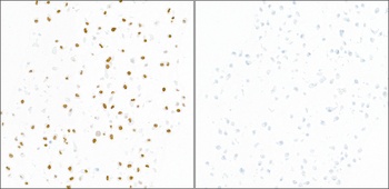 Rabbit anti-Phospho KAP-1 (S824) Recombinant Monoclonal Antibody [BL-246-7B5]