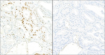 Rabbit anti-Phospho KAP-1 (S824) Recombinant Monoclonal Antibody [BL-246-7B5]