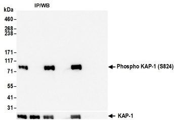 Rabbit anti-Phospho KAP-1 (S824) Recombinant Monoclonal Antibody [BL-246-7B5]