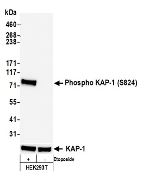 Rabbit anti-Phospho KAP-1 (S824) Recombinant Monoclonal Antibody [BL-246-7B5]