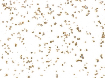Rabbit anti-CD45 Recombinant Monoclonal Antibody [BL-178-12C7]