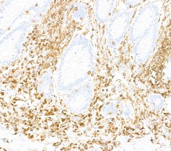 Rabbit anti-CD45 Recombinant Monoclonal Antibody [BL-178-12C7]