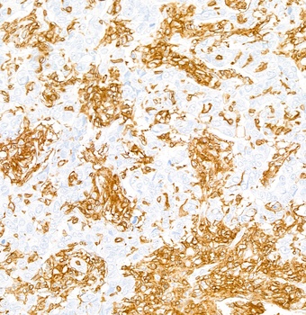 Rabbit anti-CD45 Recombinant Monoclonal Antibody [BL-178-12C7]